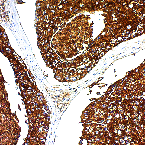 Epithelial Membrane Antigen; Clone E29 (Ready-To-Use)